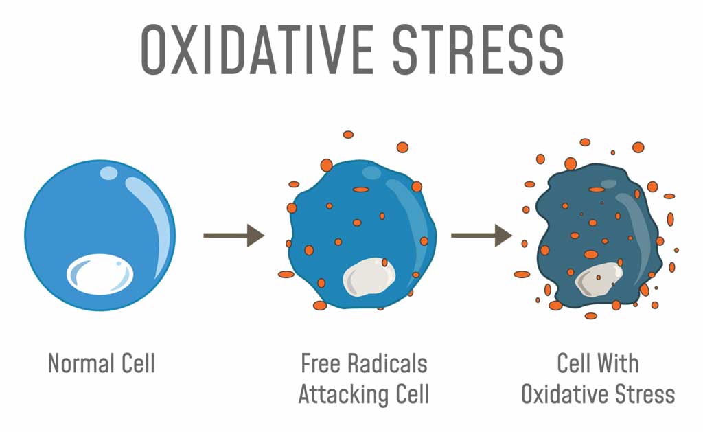 What are Free Radicals?
